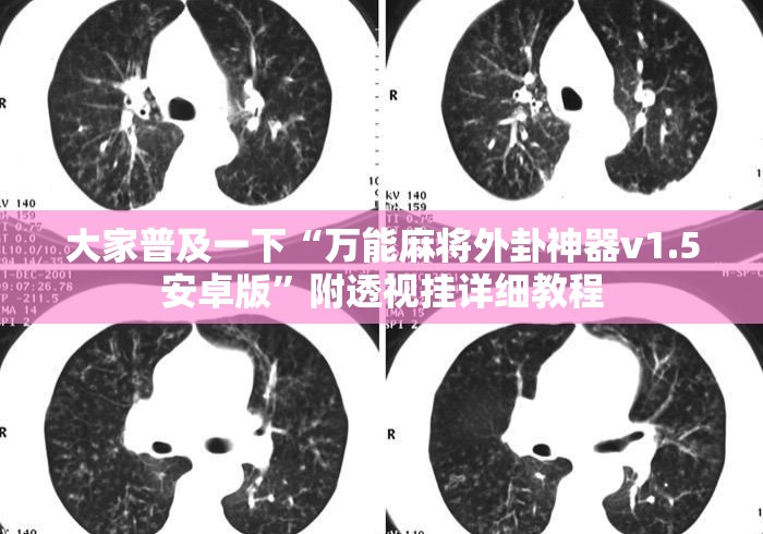 大家普及一下“万能麻将外卦神器v1.5安卓版”附透视挂详细教程
